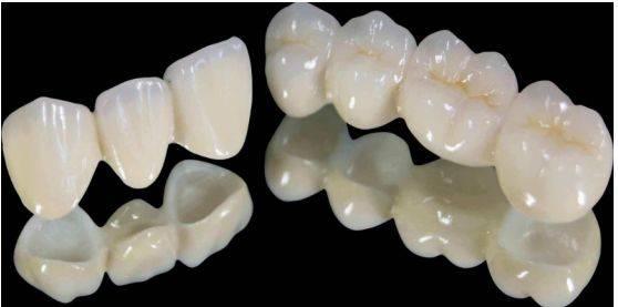 牙齿不小心摔断了，有没有办法补救？